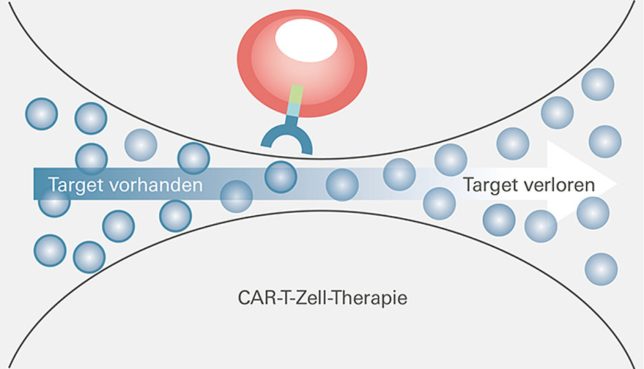 Schaubild einer CAR-T-Zell-Therapie
