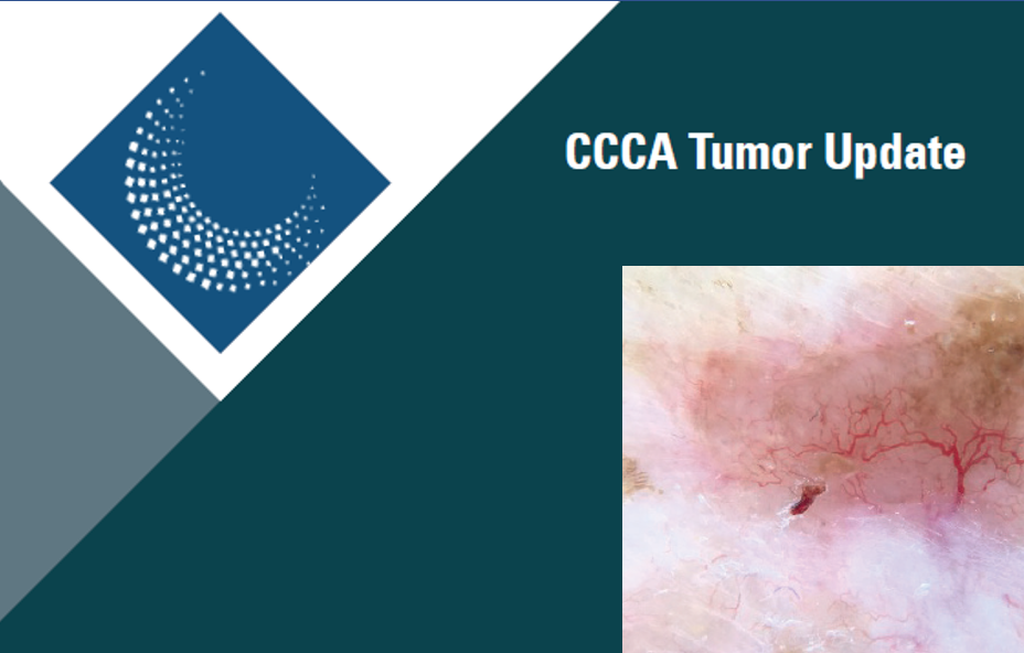 CCCA Tumor Update – Nichtmelanozytärer Hautkrebs