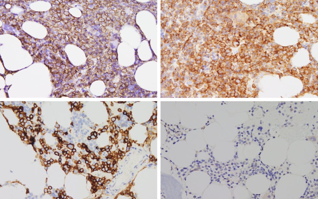 Parallelevolutionen von Tumorzellen und Rüsseltieren
