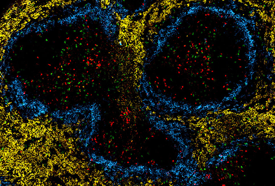 Gesunde (rot) und erschöpfte (grün) T-Zellen in der Milz einer chronisch infizierten Maus. (Bild: Ana Maria Mansilla / Institut für Systemimmunologie, Universität Würzburg)